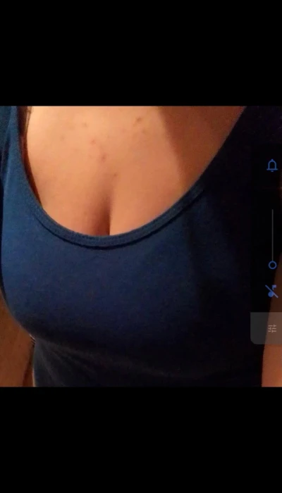 Anna593